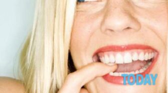 Dents blanches naturellement : voici comment avoir un sourire parfait