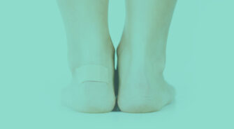 Illustration de la maladie de Haglund avec un pied présentant des symptômes visibles